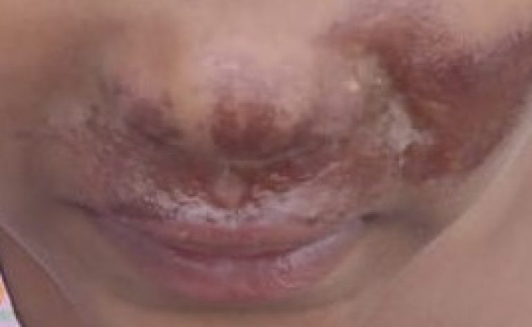 maus-tratos criança Campos Belos